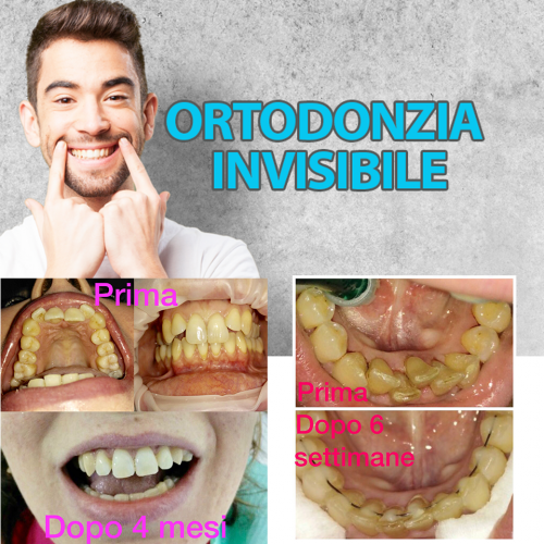 pop-up-ortodonzia